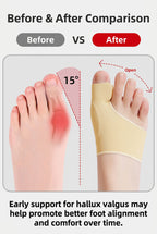 Before and after comparison graphic for a thumb spica toe splint. The left side shows a bare foot with a red pain/pressure area and a 15-degree angle indicator.
