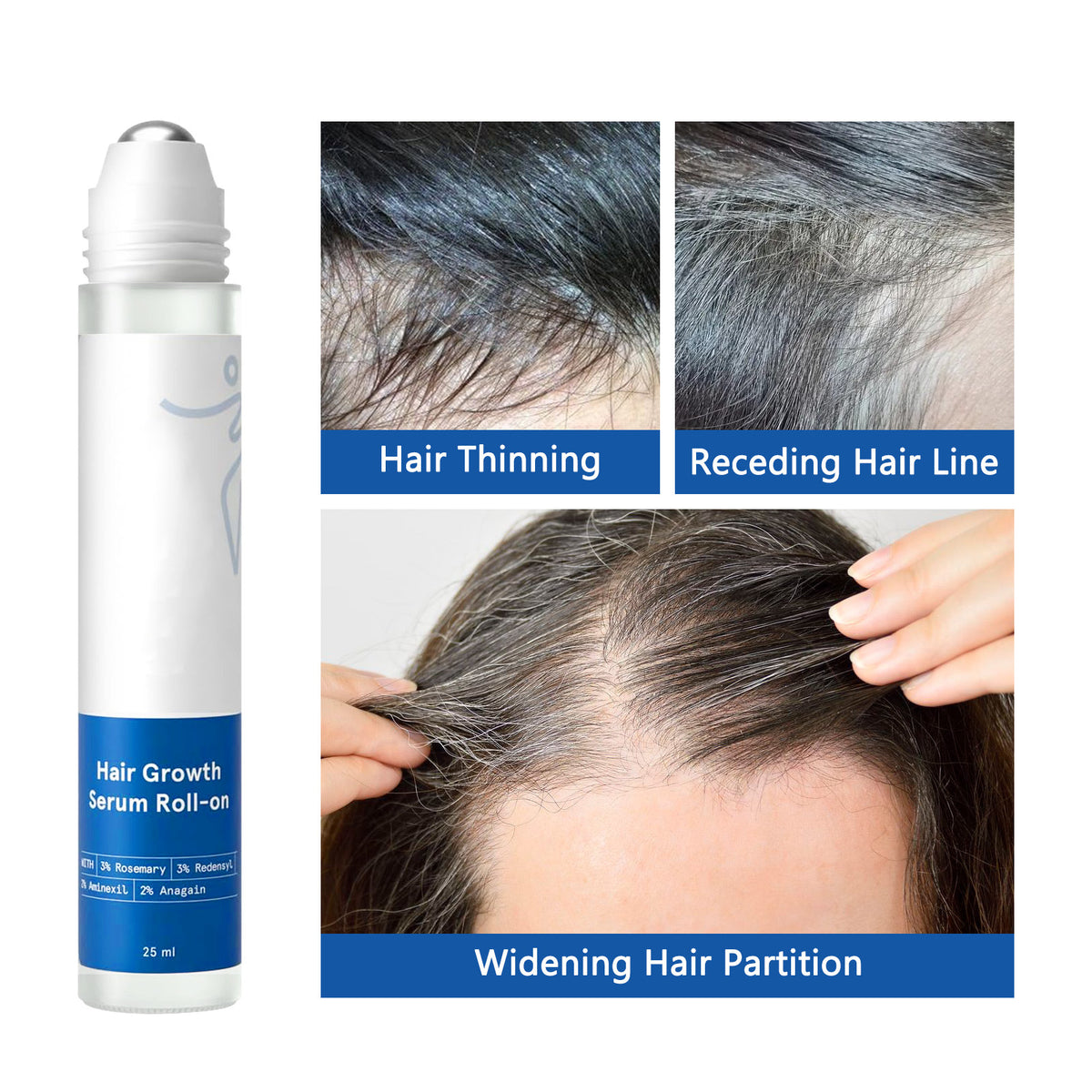 Rosemary Hair & Scalp Roll-On Serum – 25ml